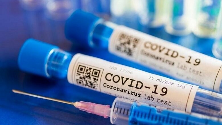 8 новых случаев заражения COVID-19 зарегистрировано в Никополе и районе